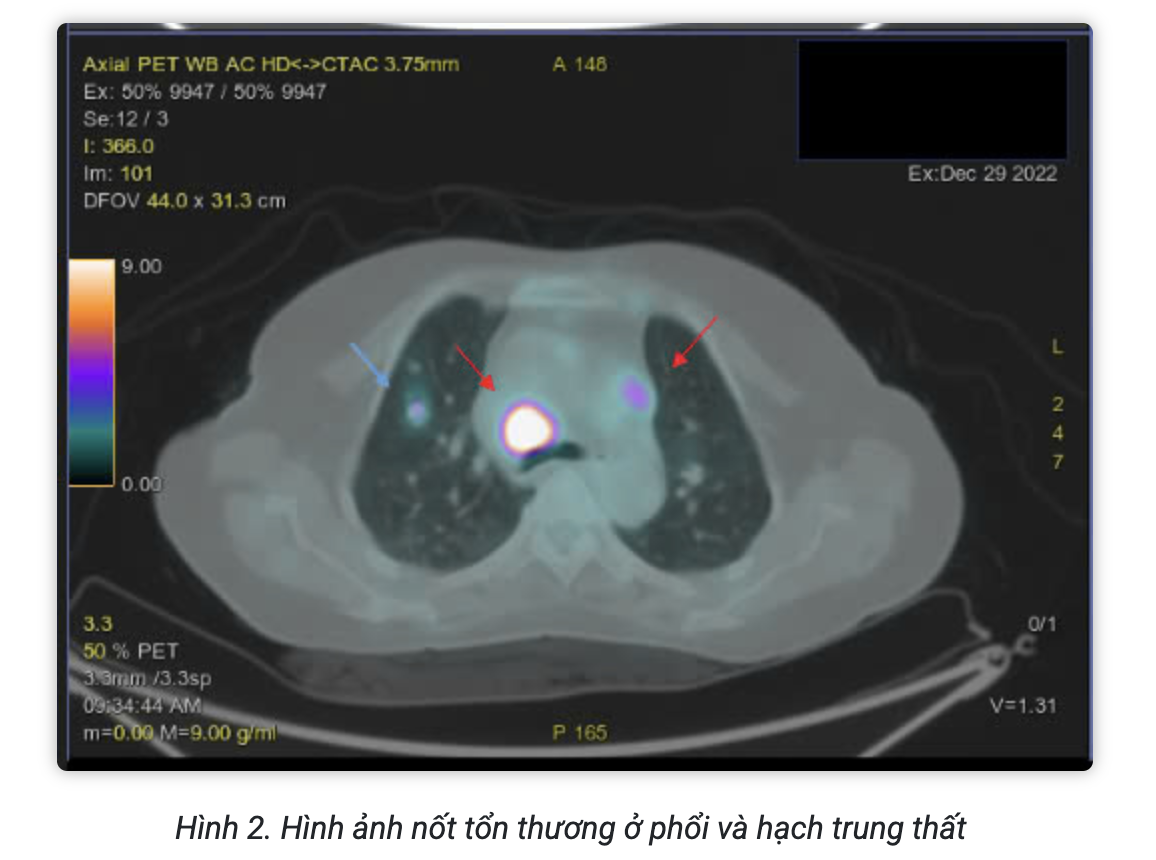 Screenshot 2026-02-25 at 15.11.44.png