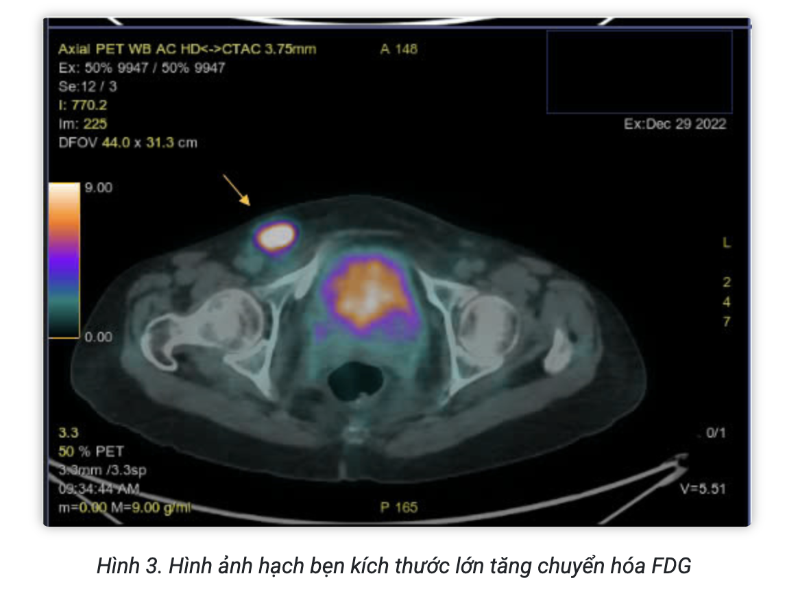 Screenshot 2026-02-25 at 15.11.54.png