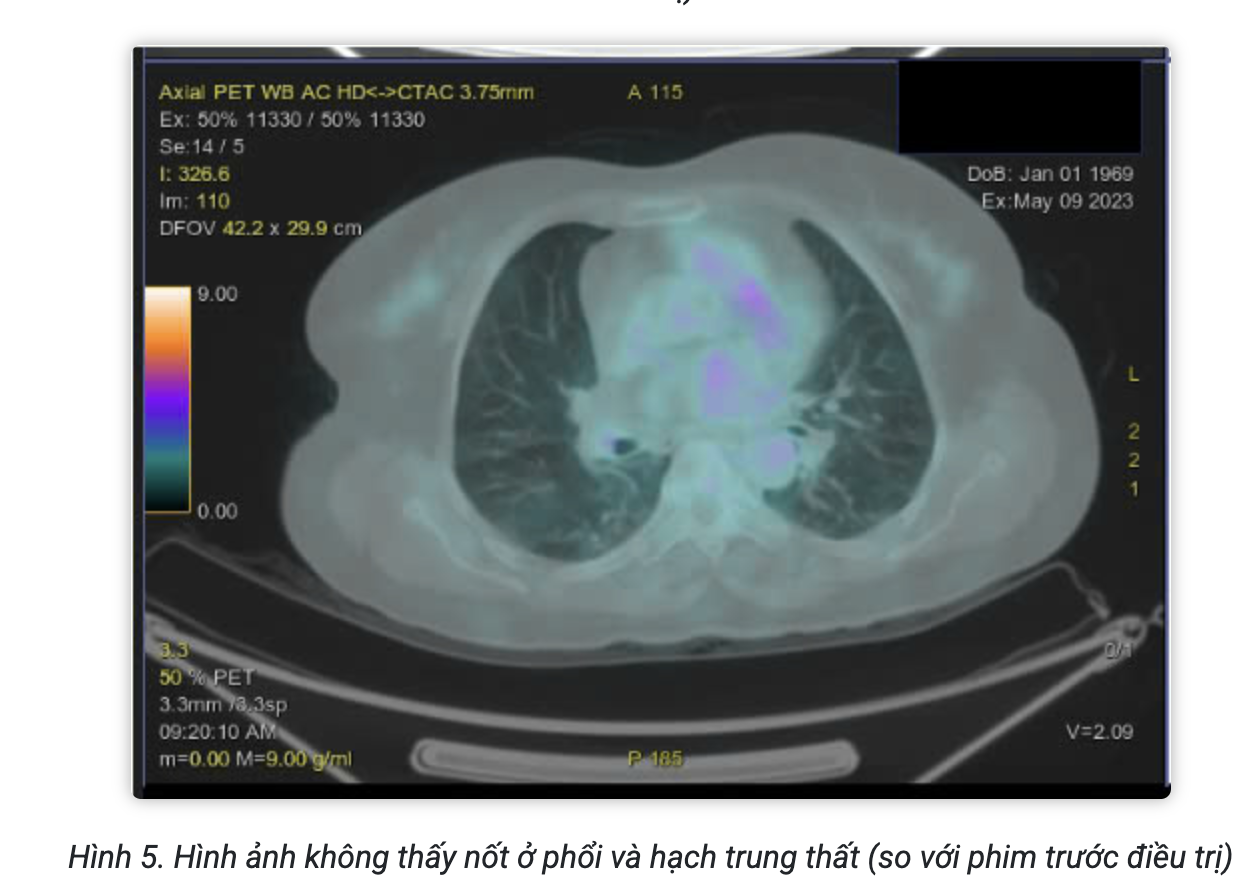 Screenshot 2026-02-25 at 15.12.18.png