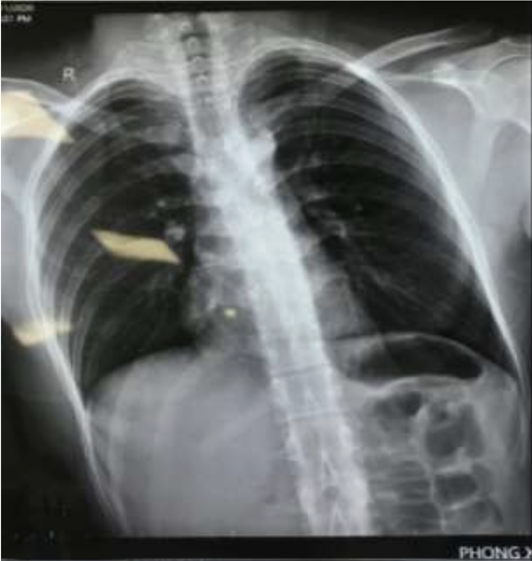 Screenshot 2026-03-03 at 18.01.28.png