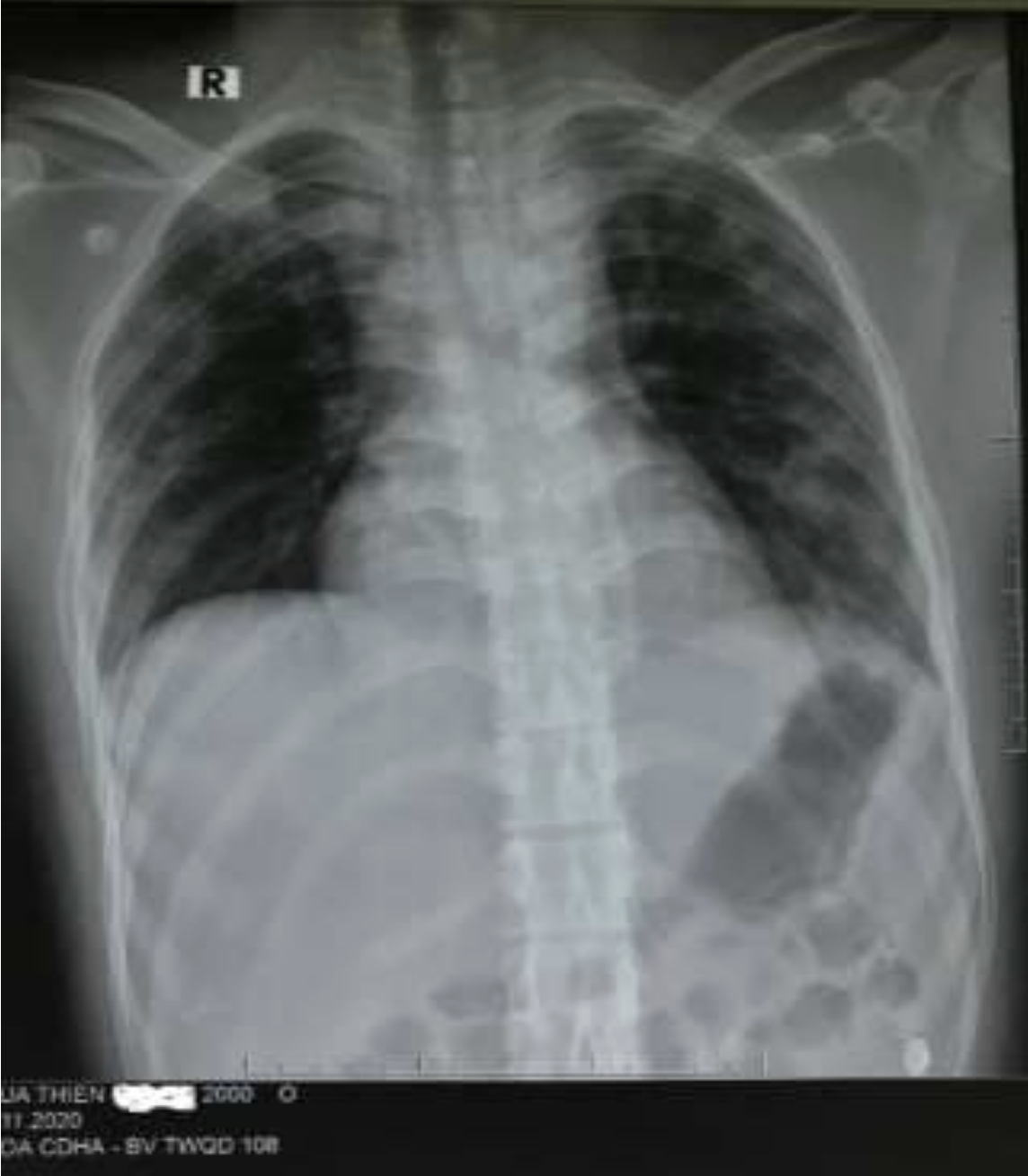 Screenshot 2026-03-03 at 18.03.28.png