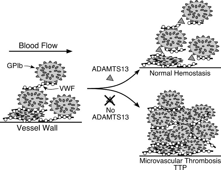 Ca lâm sàng bệnh xuất huyết giảm tiểu cầu huyết khối điều trị tại Khoa Hóa trị liệu và Bệnh máu (A6-B) .jpg