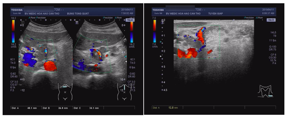K thực quan - 2.png