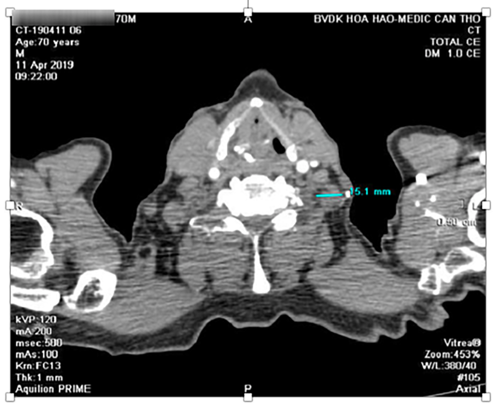 K thực quan - 5.png