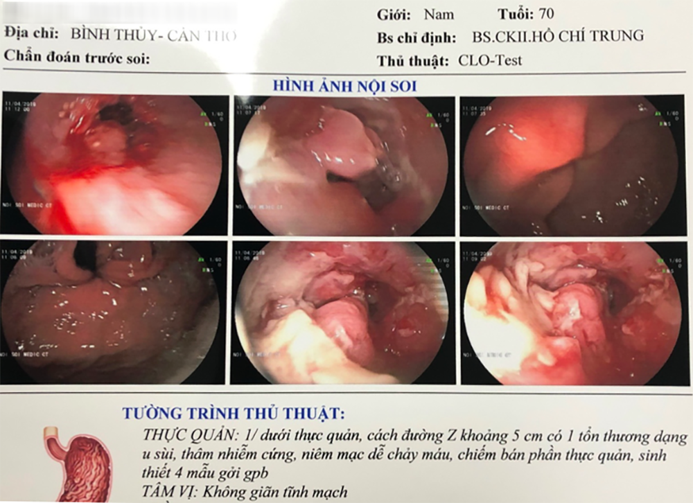 K thực quan - 6.png