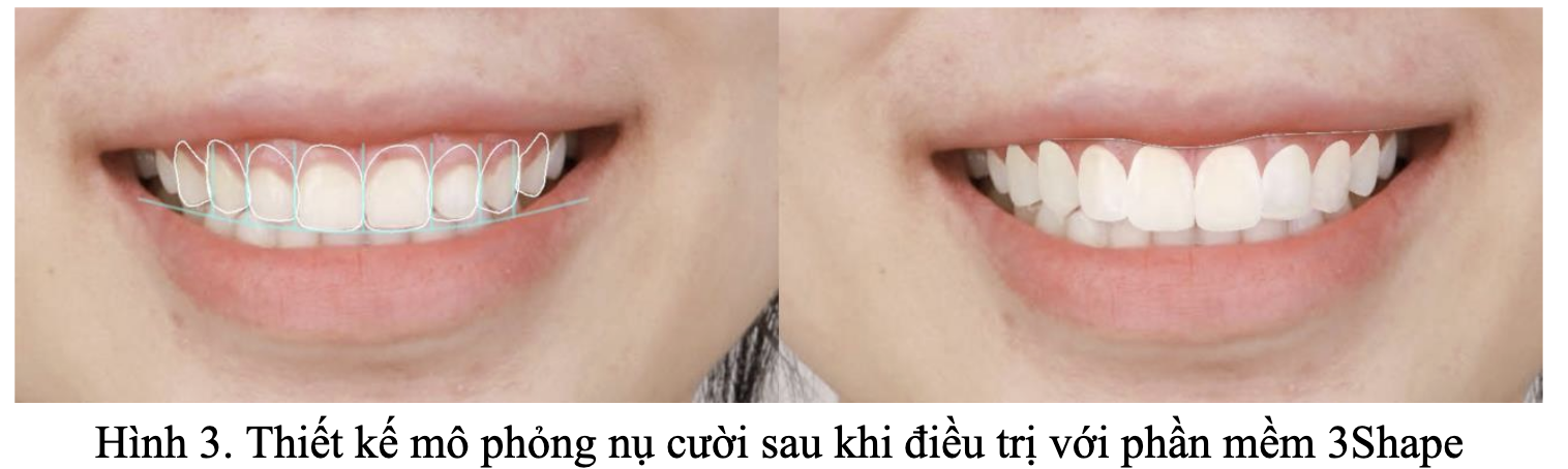 Screenshot 2026-03-12 at 17.03.10.png