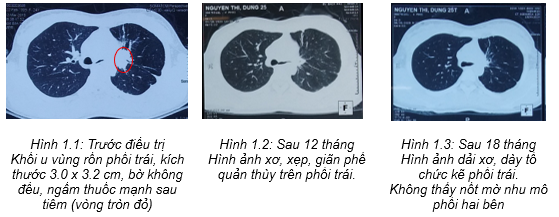 bv bạch mai -2.png