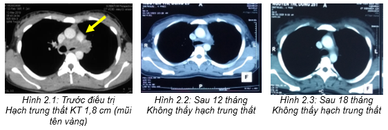 bv bạch mai -3.png