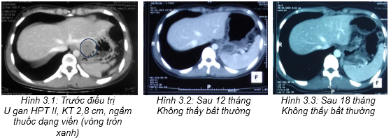 bv bạch mai -4.png