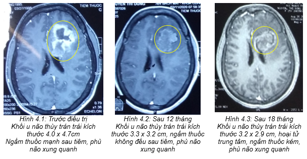 bv bạch mai -5.png