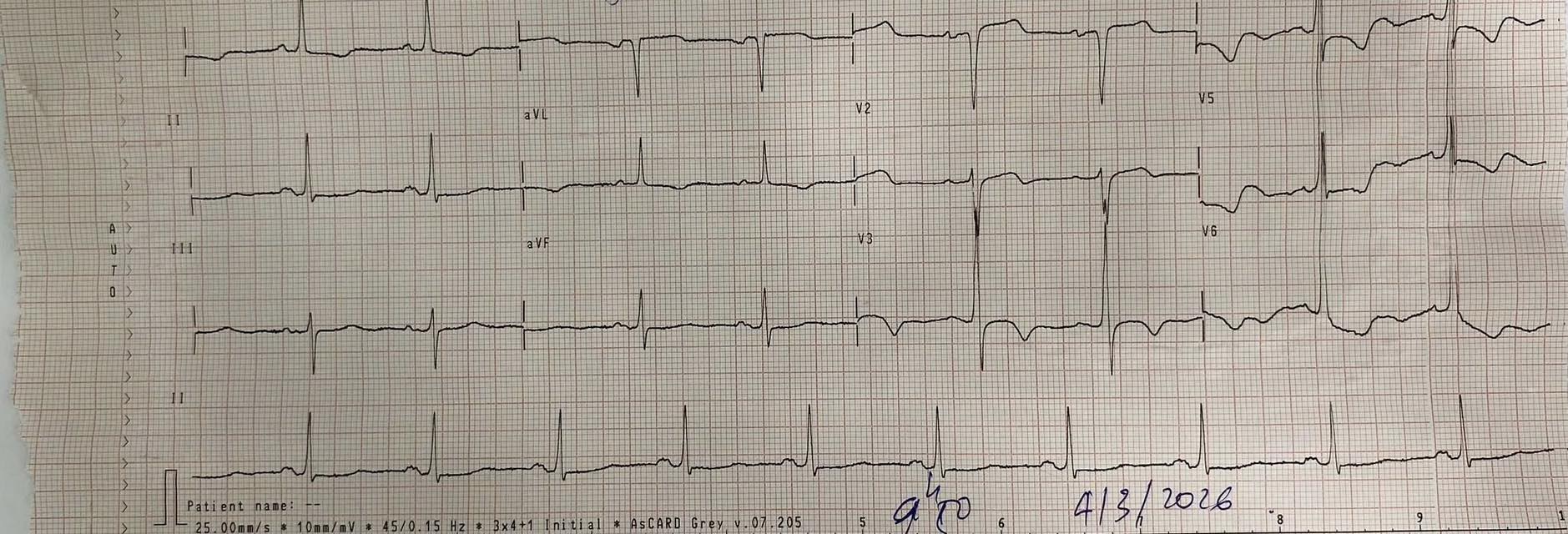 Dự phòng cường giáp do thuốc cản quang chứa iod ở bệnh nhân nguy cơ cao 2.jpg