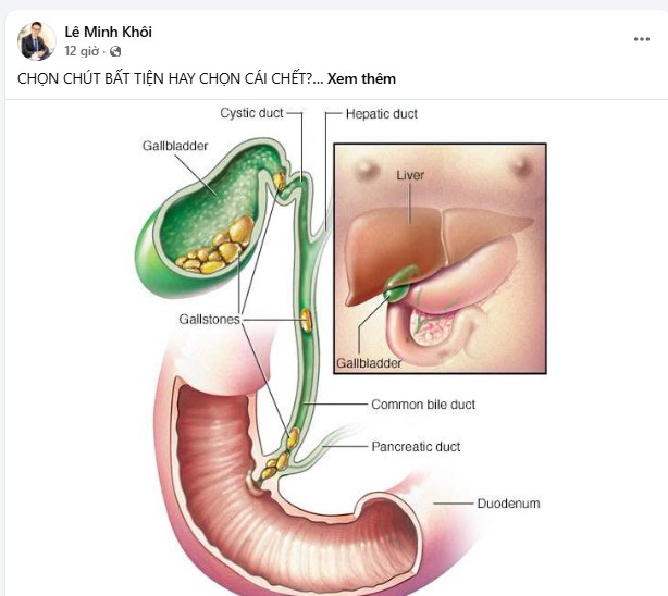 alobacsi le minh khoi.jpg